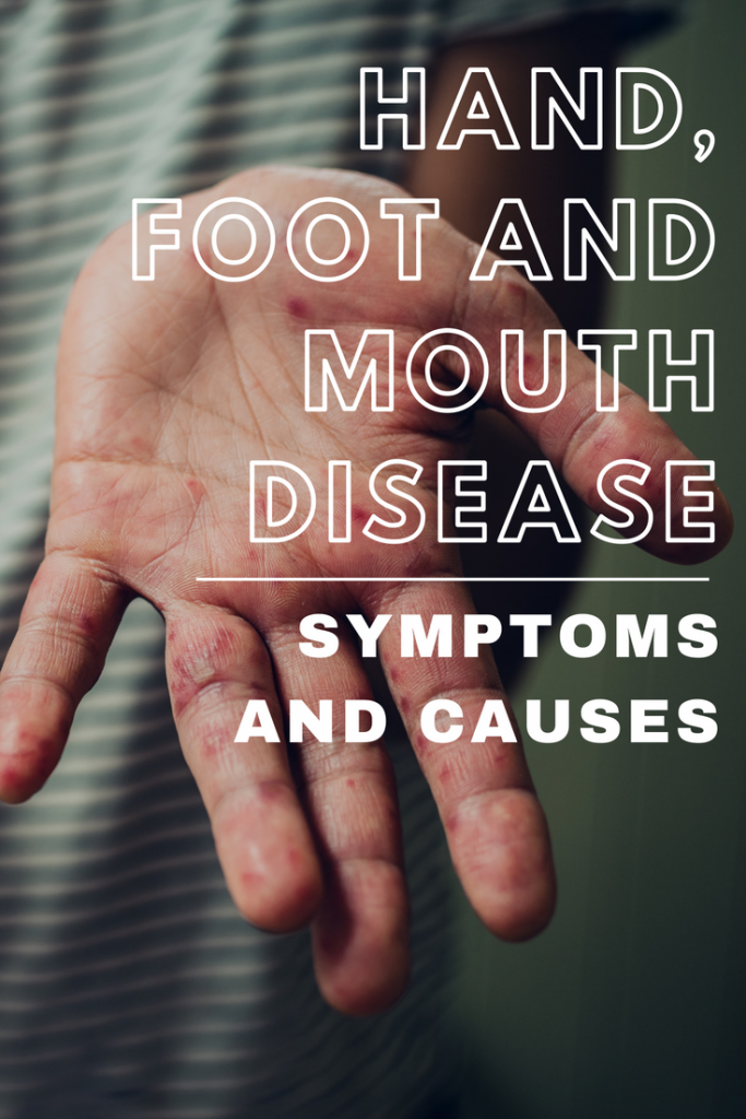 Hand, Foot and Mouth Disease, HFMD