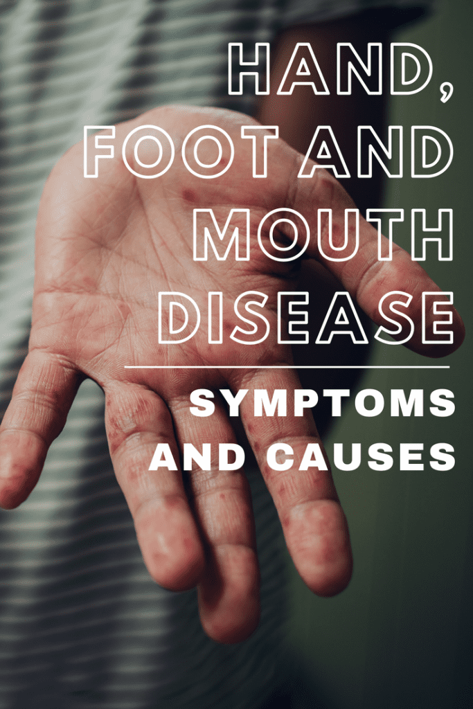 Hand, Foot and Mouth Disease, HFMD